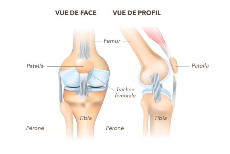 Arthrose du genou (gonarthrose) : les symptômes et traitements